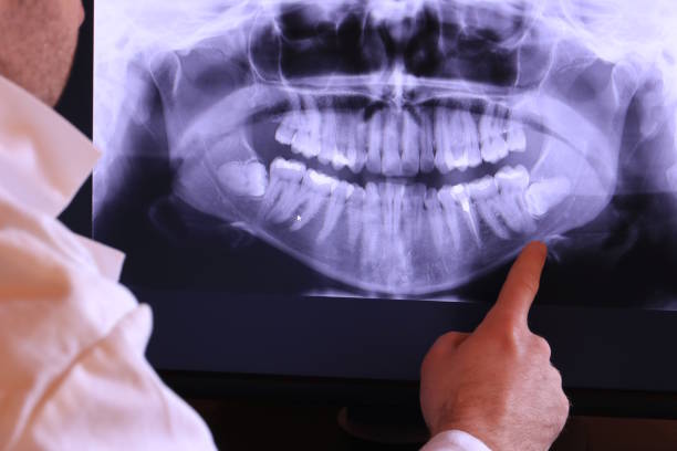 Best Broken or Cracked Tooth Emergency Dentist in Central Point, OR