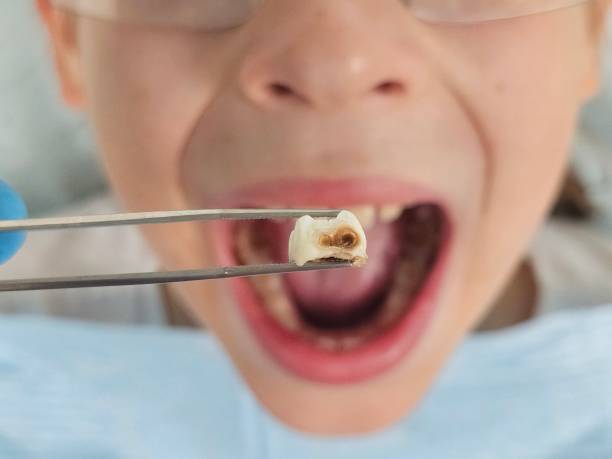 Best Pediatric Emergency Dentist in Central Point, OR